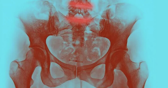 The Sciatica Myth: How the Western Healthcare Construct Labels Your Tightness for Profit
